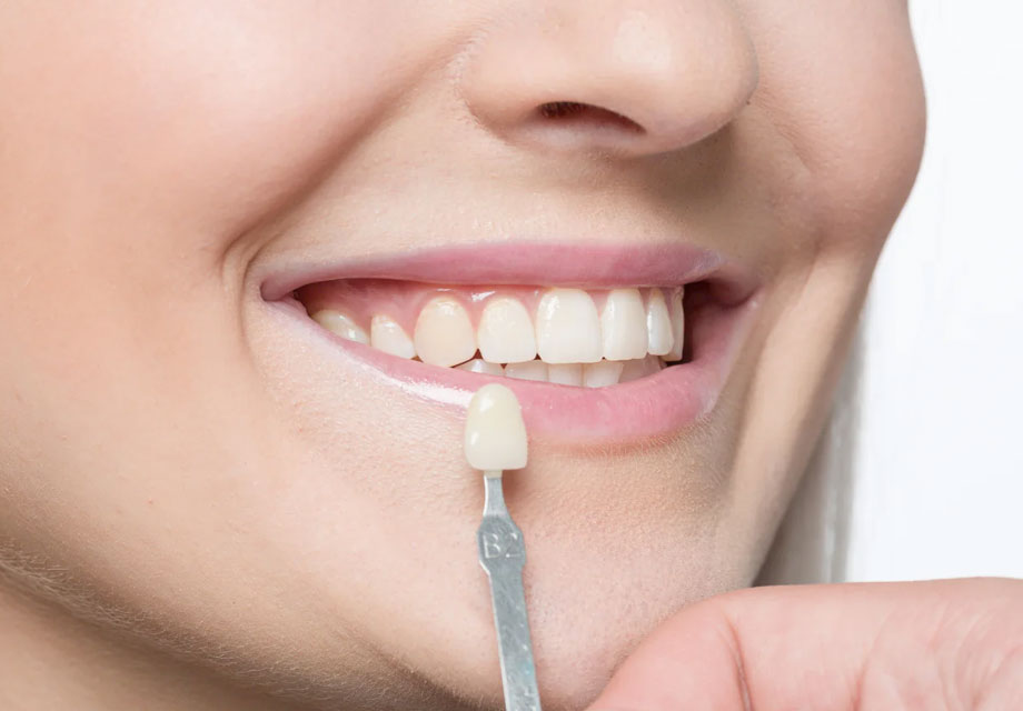 img-chawlaorthodontics-blog-13