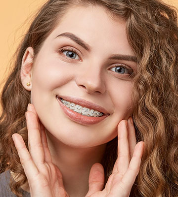 img-chawlaorthodontics-treatment-braces-ceramicbraces-01