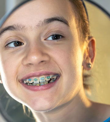 img-chawlaorthodontics-treatment-braces-metalbraces-03