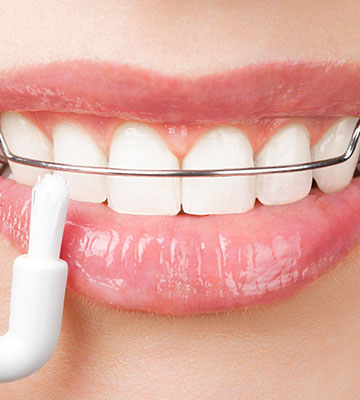 img-smilemaintenance-retainerassurance-01