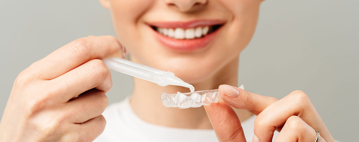 img-smilemaintenance-teethwhitening-02 img-smilemaintenance-teethwhitening-02