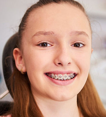 img--treatment-braces-kid-03