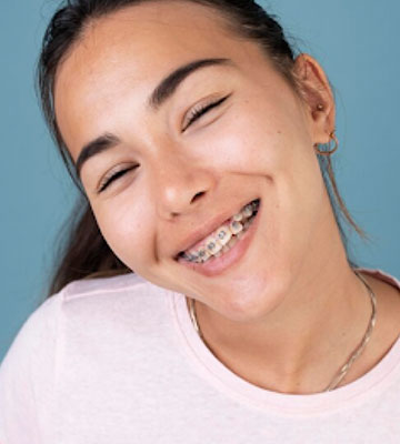 img--treatment-braces-teen-03