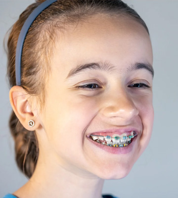 Braces-for-Children
