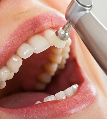 img-chawlaorthodontics-routinedentalcleaning-01