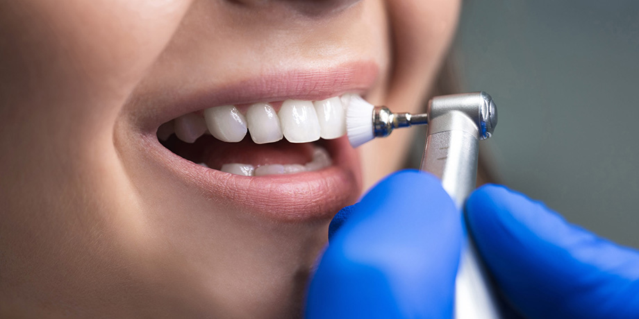 img-chawlaorthodontics-routinedentalcleaning-02