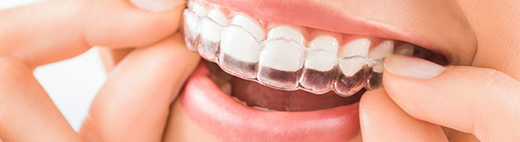 img-homechawlaorthodontics-orthodontics-header